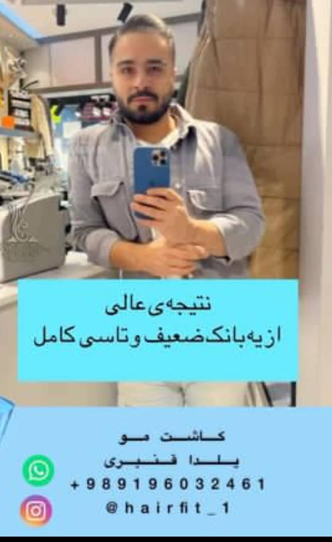 کاشت مو و ابرو و ریش یلدا قنبری در سعادت آباد تهران ، آدرس کاشت مو و ابرو و ریش یلدا قنبری در سعادت آباد تهران ، ایران مشاغل سامانه برتر ثبت مشاغل کشور