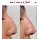 مطب زیبایی پوست و مو دکتر بینا احمدی نژاد در تهران