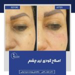 کلینیک تخصصی زیبایی پوست و مو تندیس سلامت در مشهد