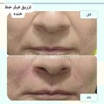 کلینیک تخصصی زیبایی پوست و مو تندیس سلامت در مشهد