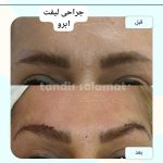 کلینیک تخصصی زیبایی پوست و مو تندیس سلامت در مشهد