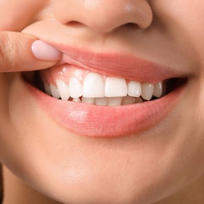 لیفت لثه چیست؟ ، ایران مشاغل سامانه برتر ثبت مشاغل کشور
