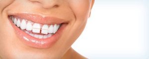 علت فاصله افتادن بین دندان ها در بزرگسالی و کودکی چیست؟