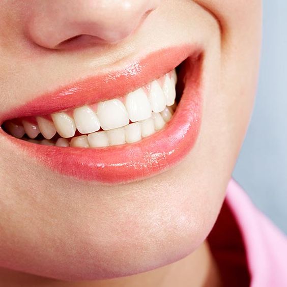 لیفت لثه چیست؟ ، ایران مشاغل سامانه برتر ثبت مشاغل کشور
