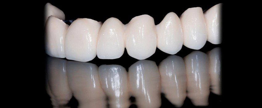 Dental Crown چیست؟ ، ایران مشاغل سامانه برتر ثبت مشاغل کشور