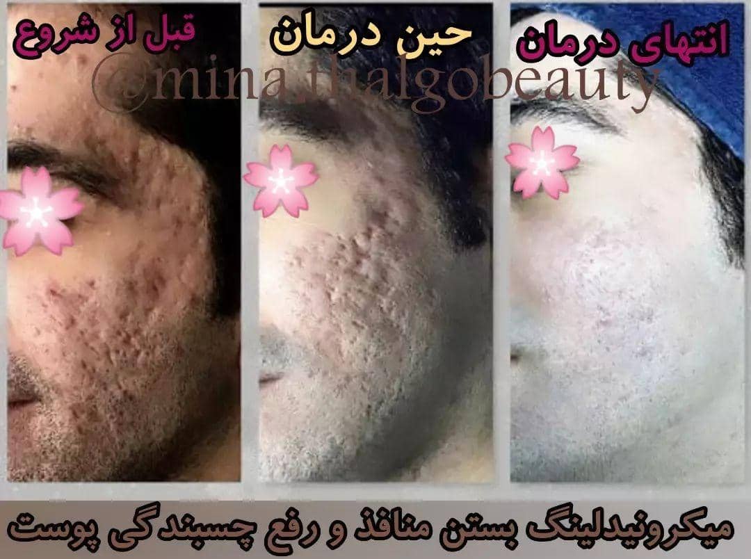 کلینیک زیبایی پوست و مو و لاغری و لیزر ماه مینا در شاهد شیراز ، آدرس کلینیک زیبایی پوست و مو و لاغری و لیزر ماه مینا در شاهد شیراز ، ایران مشاغل سامانه برتر ثبت مشاغل کشور