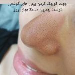 کلینیک زیبایی پوست و مو و لاغری و لیزر ماه مینا در شاهد شیراز