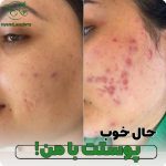 آکادمی تخصصی فیشیال و پاک سازی پوست و آرایش دائم رویا راد در شیراز