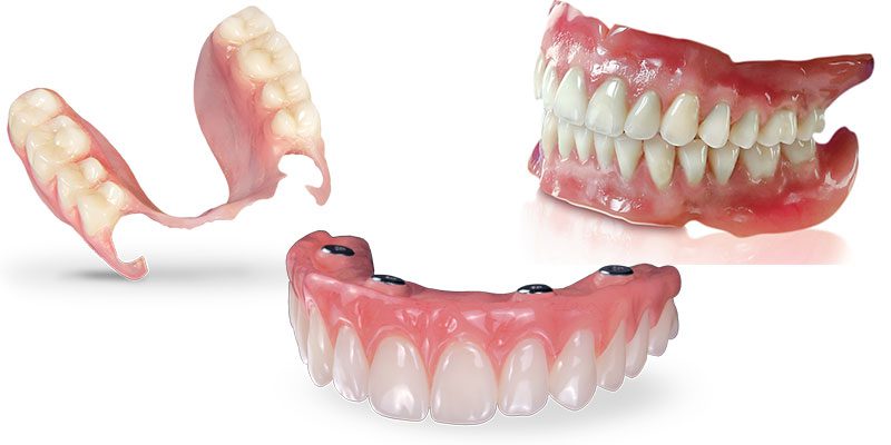 تفاوت دندان متحرک و مصنوعی چیست ؟ ، ایران مشاغل سامانه برتر ثبت مشاغل کشور
