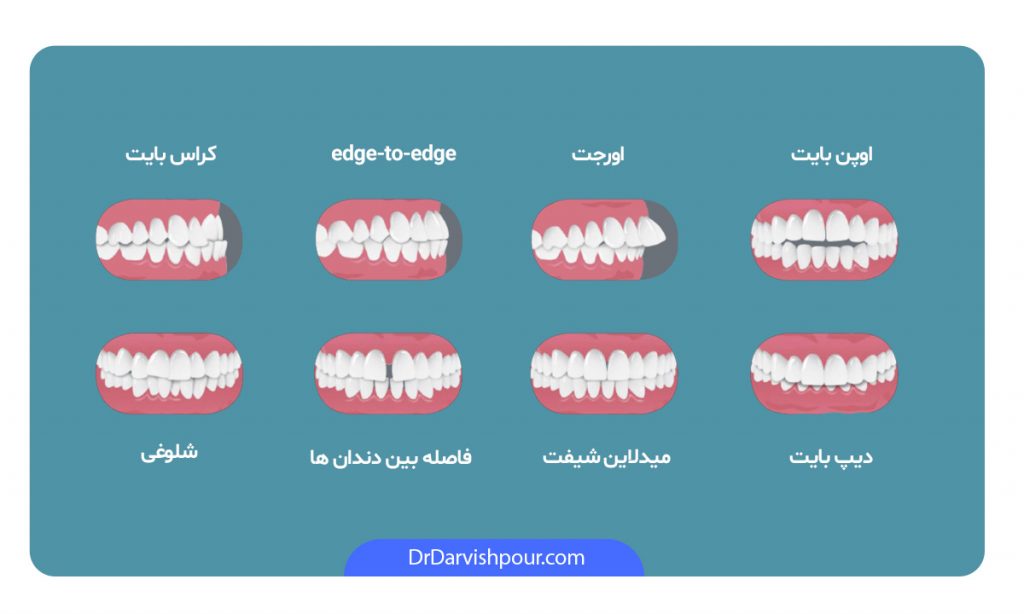 همه چیز درباره ارتودنسی متحرک ، ایران مشاغل سامانه برتر ثبت مشاغل کشور