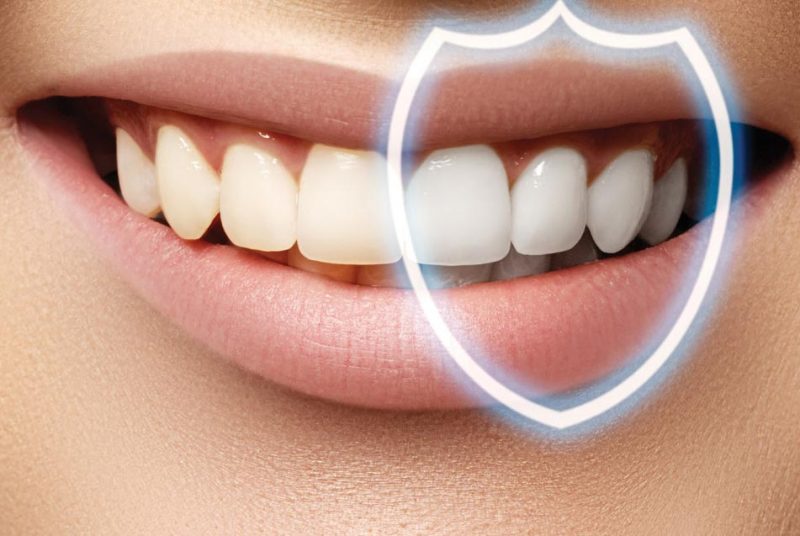 روکش دندان چیست؟ ، ایران مشاغل سامانه برتر ثبت مشاغل کشور