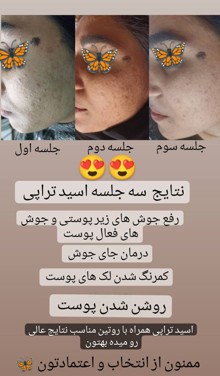 آموزش و خدمات فشیال تخصصی و پاکسازی پوست ساجده افضلی در مشهد ، آدرس آموزش و خدمات فشیال تخصصی و پاکسازی پوست ساجده افضلی در مشهد ، ایران مشاغل سامانه برتر ثبت مشاغل کشور