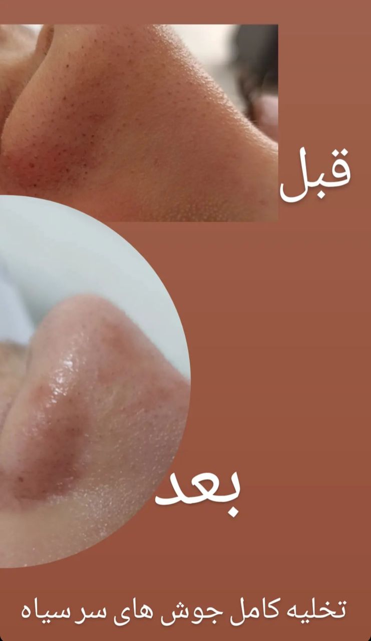 آموزش و خدمات فشیال تخصصی و پاکسازی پوست ساجده افضلی در مشهد ، آدرس آموزش و خدمات فشیال تخصصی و پاکسازی پوست ساجده افضلی در مشهد ، ایران مشاغل سامانه برتر ثبت مشاغل کشور