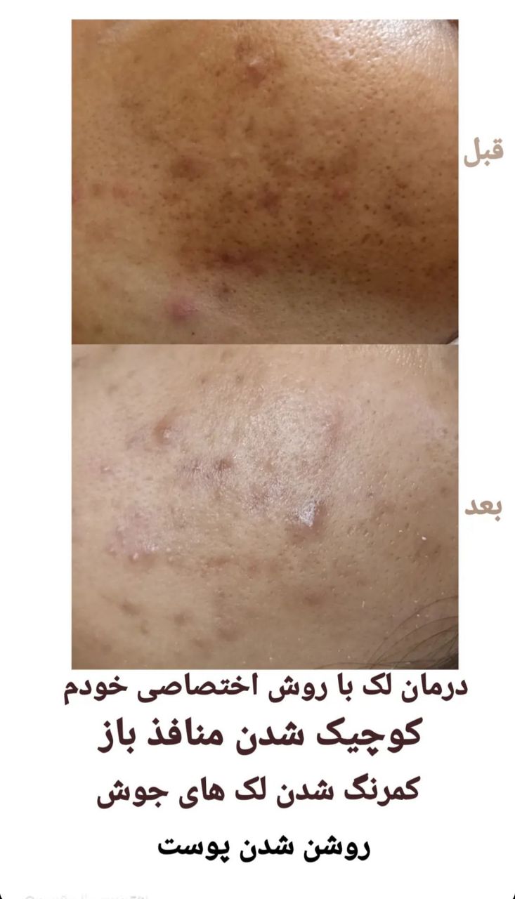 آموزش و خدمات فشیال تخصصی و پاکسازی پوست ساجده افضلی در مشهد ، آدرس آموزش و خدمات فشیال تخصصی و پاکسازی پوست ساجده افضلی در مشهد ، ایران مشاغل سامانه برتر ثبت مشاغل کشور