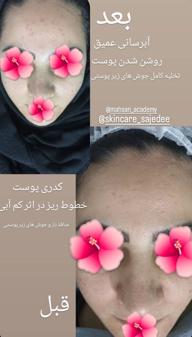 آموزش و خدمات فشیال تخصصی و پاکسازی پوست ساجده افضلی در مشهد ، آدرس آموزش و خدمات فشیال تخصصی و پاکسازی پوست ساجده افضلی در مشهد ، ایران مشاغل سامانه برتر ثبت مشاغل کشور