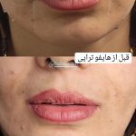 کلینیک زیبایی و لیزر سلاطین طب در زرند کرمان