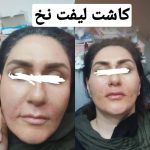 مطب زیبایی میری در تبریز