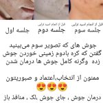 آموزش و خدمات فشیال تخصصی و پاکسازی پوست ساجده افضلی در مشهد