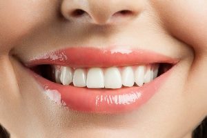 درباره تحلیل لثه بیشتر بدانیم