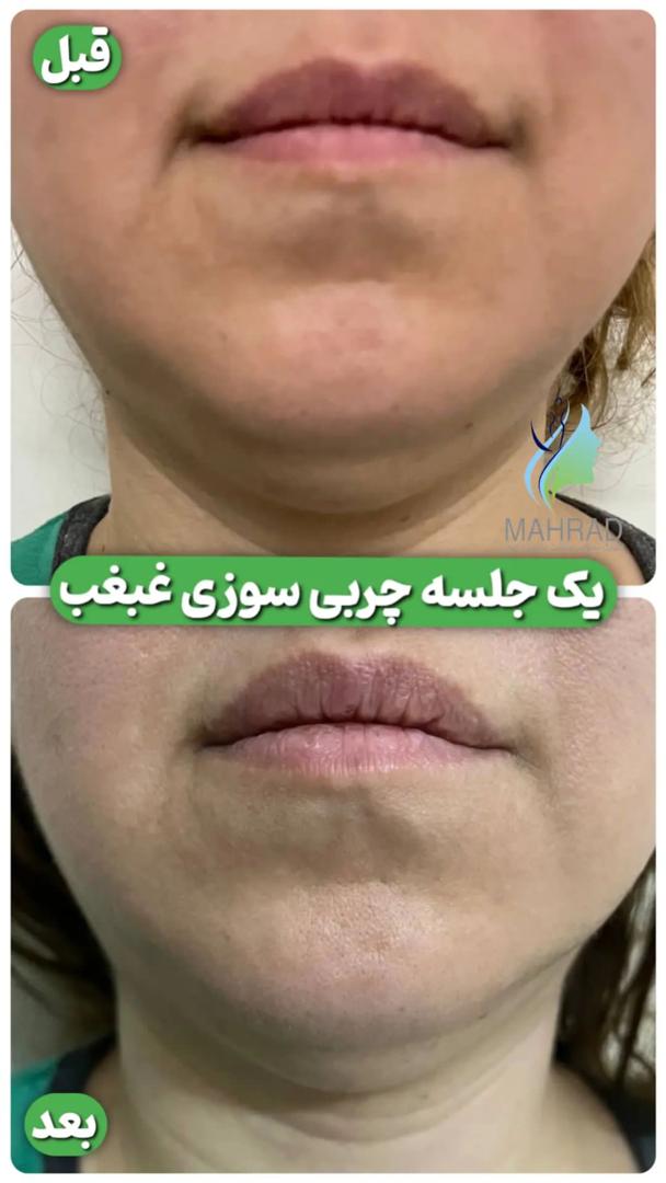 کلینیک تخصصی پوست و مو و لاغری مهراد در فلسطین شمالی تهران ، آدرس کلینیک تخصصی پوست و مو و لاغری مهراد در فلسطین شمالی تهران ، ایران مشاغل سامانه برتر ثبت مشاغل کشور