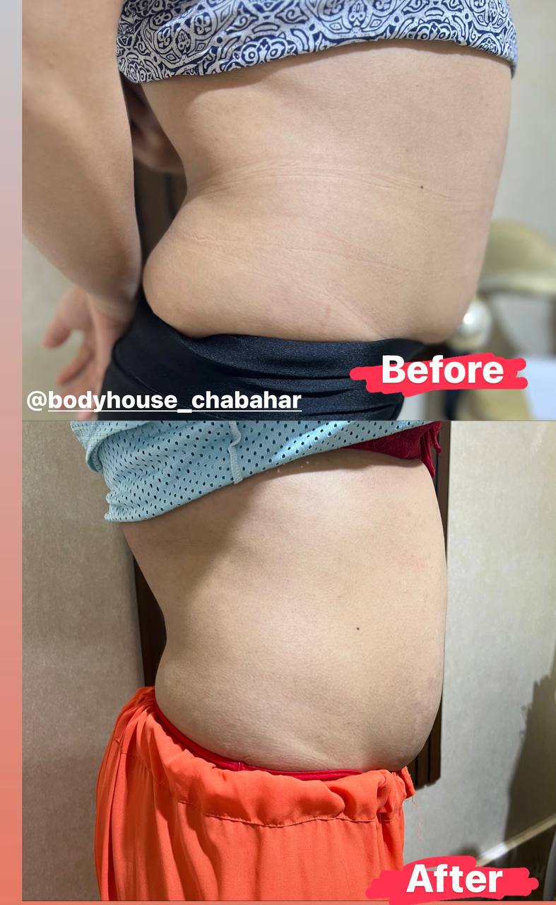 کلینیک تخصصی لاغری و پیکر تراشی body house در چابهار ،آدرس کلینیک تخصصی لاغری و پیکر تراشی body house در چابهار ،ایران مشاغل سامانه برتر ثبت مشاغل کشور 