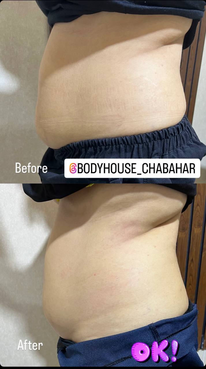 کلینیک تخصصی لاغری و پیکر تراشی body house در چابهار ،آدرس کلینیک تخصصی لاغری و پیکر تراشی body house در چابهار ،ایران مشاغل سامانه برتر ثبت مشاغل کشور 