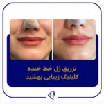 مرکز لیزر و کلینیک زیبایی بهشید در اراک