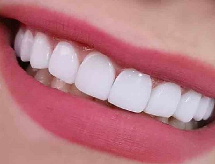 کراودینگ دندان چیست ؟ایران مشاغل سامانه برتر ثبت مشاغل کشور 