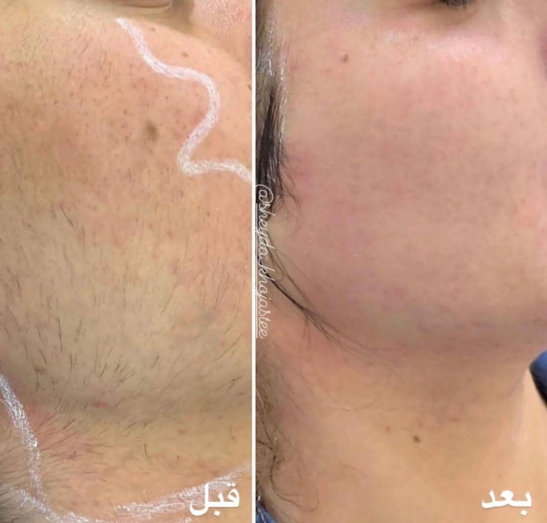 کلینیک تخصصی آموزش و خدمات لیزر شیدا خجسته در بندرعباس ،آدرس کلینیک تخصصی آموزش و خدمات لیزر شیدا خجسته در بندرعباس ،ایران مشاغل سامانه برتر ثبت مشاغل کشور 