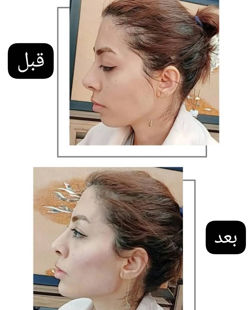 کلینیک تخصصی زیبایی فیلر بادی و زاویه سازی صورت بنیتا در شرق تهران ،آدرس کلینیک تخصصی زیبایی فیلر بادی و زاویه سازی صورت بنیتا در شرق تهران ،ایران مشاغل سامانه برتر ثبت مشاغل کشور 