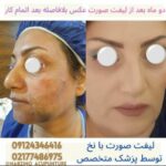 کلینیک تخصصی زیبایی لیفت نخ و طب سوزنی نبضی نو در تهران