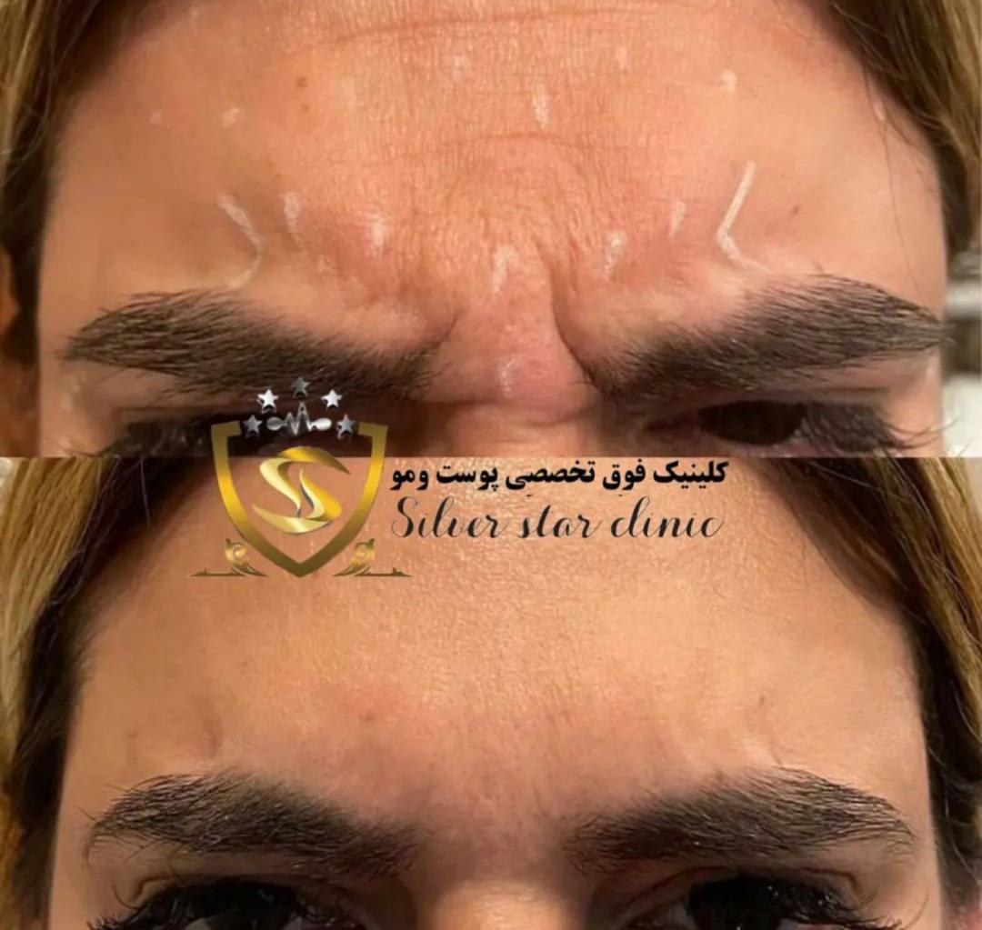 کلینیک زیبایی کاشت مو و ابرو ستاره نقره ای Silver star در شریعتی تهران ، آدرس کلینیک زیبایی کاشت مو و ابرو ستاره نقره ای Silver star در شریعتی تهران ، ایران مشاغل سامانه برتر ثبت مشاغل کشور