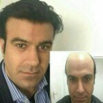 کلینیک زیبایی کاشت مو و ابرو ستاره نقره ای Silver star در شریعتی تهران