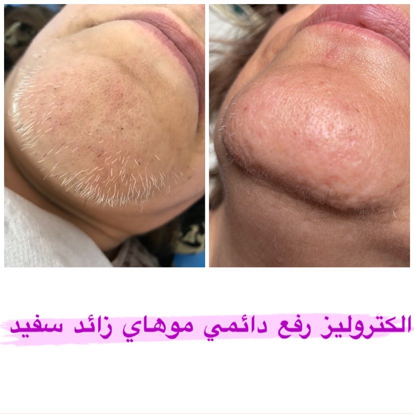 خدمات تخصصی زیبایی لیزر موهای زائد مرکز تخصصی ایپک در تبریز ، آدرس خدمات تخصصی زیبایی لیزر موهای زائد مرکز تخصصی ایپک در تبریز ، ایران مشاغل سامانه برتر ثبت مشاغل کشور