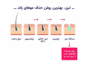 مرکز لیزر و پوست و مو اکبریان در کرمان ، آدرس مرکز لیزر و پوست و مو اکبریان در کرمان ، ایران مشاغل سامانه برتر ثبت مشاغل کشور