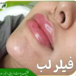 مرکز لیزر و زیبایی سون Seven در کیانشهر تهران