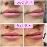 مطب زیبایی ایپک در تبریز