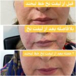 مطب زیبایی ایپک در تبریز