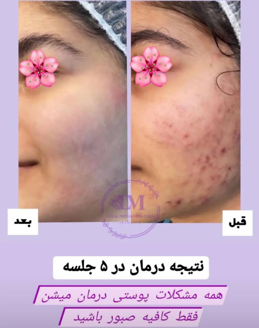 آموزش و خدمات تخصصی پاکسازی پوست لیلا محمدیان در اهواز ، آدرس آموزش و خدمات تخصصی پاکسازی پوست لیلا محمدیان در اهواز ، ایران مشاغل سامانه برتر ثبت مشاغل کشور