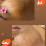 آموزش و خدمات تخصصی پاکسازی پوست لیلا محمدیان در اهواز