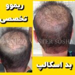 مرکز آموزش و خدمات میکرواسکالپ و اسکالپ سر سوشا احمدی در تهران