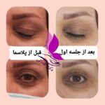 مطب زیبایی و لیزر دکتر فاطمه قدرتی در شیراز