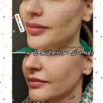 مطب زیبایی پوست و مو دکتر معصومه گودرزی در بروجرد