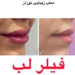 کلینیک زیبایی و لیزر نوران در صادقیه تهران