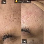 مرکز تخصصی فیشیال پوست فاطمه فخیره در زابل