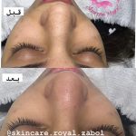 مرکز تخصصی فیشیال پوست فاطمه فخیره در زابل