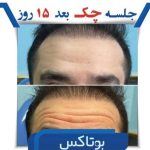 کلینیک تخصصی زیبایی جوانسازی موراشین در بلوار فردوس تهران