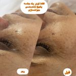 مرکز تخصصی فیشیال پوست فاطمه فخیره در زابل