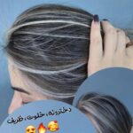 مرکز تخصصی پوست و مو هلما در صومعه سرا