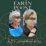 مرکز زیبایی پوست و مو فرین پوست در مصلی اصفهان